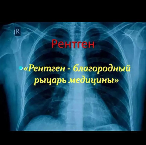 Рентген на дому Москва, Флюорография на дом Москва, Цифровой рентген на дому Москва, Травматолог на дом Москва, ЛОР на дом Москва , Стоматолог на дом, Нарколог на дом Москва, Психолог на дом, Невролог на дом, УЗИ на дому Москва, ЭКГ на дому Москва, Анализы на дому Москва, бесплатно по полису ДМС добровольное медицинское страхование. 
Балканская рамка - ( аренда и продажа) ; 
#рентген_на_дому #рентген_на_дому_Москва
О НАСТОЙКЕ ХРЕНА 
(АНГИНА, ГРИПП, ЛЕЧЕНИЕ АНГИНЫ, ГРИППА. ЗУБНАЯ БОЛЬ, ПОМОЩЬ ПРИ ЗУБНОЙ БОЛИ) 
Ее применение очень широкое. При ангине полоскать горло 1 ст. ложкой и проглотить. Чаще всего за один прием все проходит. 
При гриппе делать ингаляции при помощи ингалятора. 
Помогает при ранах: я порезал палец, замотал тряпочкой, полил ее настойкой хрена — и все зажило. Никаких перевязок. 
И еще ею можно спасаться от зубной боли: набрать в рот примерно 1 ст. ложку настойки и держать на больном зубе до тех пор, пока концентрация настойки за счет выделения слюны сильно понизится. Потом проглотить или выплюнуть— кому как нравится — и набрать свежую порцию. Так повторить раз 10—15. Зуб при этом перестает болеть и надолго. 
Теперь о приготовлении настойки. Осенью выкопать толстый корень хрена, помыть холодной водой с помощью щетки, натереть на мелкой терке, поместить 
сок и жом в бутылку до половины объема и залить водкой или самогоном до горлышка, закрыть пробкой. Через 10 дней настойка готова. 
#рентген_в_москве, #рентген_легких, #перелом_шейки_бедра, #шейка_бедра, #сделать_рентген, #сделать_рентген_на_дому, #вызвать_врача, #вызвать_врача_на_дом, #врач_на_дом, #вызвать_травматолога, #травматолог_на_дом, #перелом_ребер, #вправить_вывих, #травматолог, #перелом, #травма #вывих, #флюорография, #флюорография_на_дому, #ушиб, #пневмония #функциональная_кровать #рама_балканского 
#рентген_на_дому #рентген_на_дому_Москва 
#Рама_Балканского 
#травматолог_на_дом_Москва 
#рентген_на_дому_шейки_бедра_Москва 
#рентген_на_дому_лёгкие_Москва 
#рентген_на_дому_позвоночника_Москва 
#рентген_на_дому_отзывы_Москва 
#сделать_рентген_на_дому_Москва 
#вызвать_рентген_на_дом_Москва 
#рентген_на_дому_тазобедренного_сустав 
#Московский_рентген_Рентген_на_дому_шейки_бедра